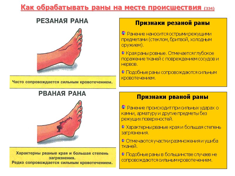 Как обрабатывать раны на месте происшествия (334) . Признаки резаной раны  Ранение наносится